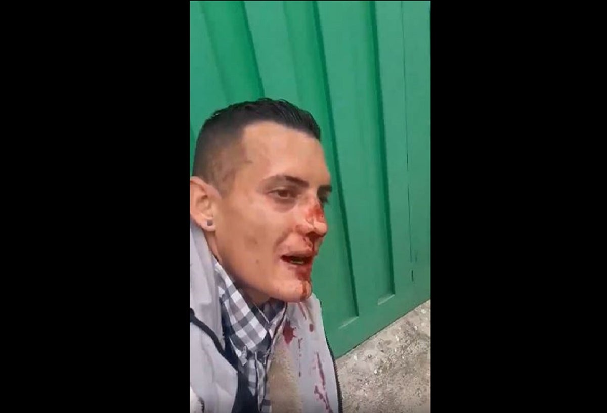 Le rompieron la nariz a ladrón de Fontibón