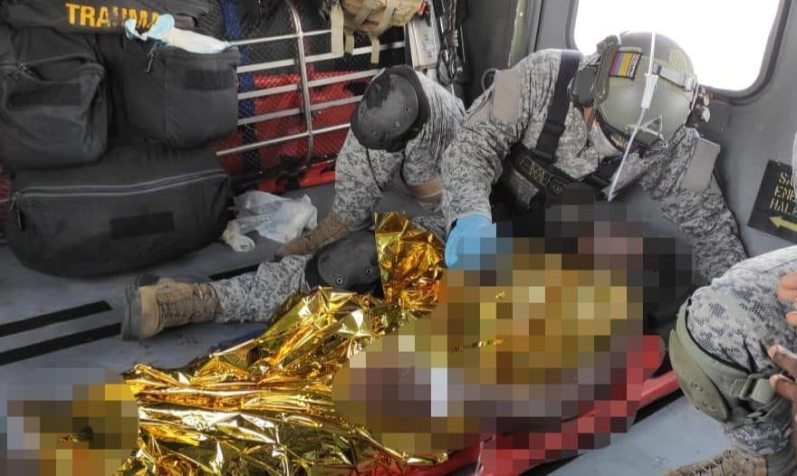 El menor sufrió graves afectaciones en sus piernas, tras pisar una mina antipersonal.