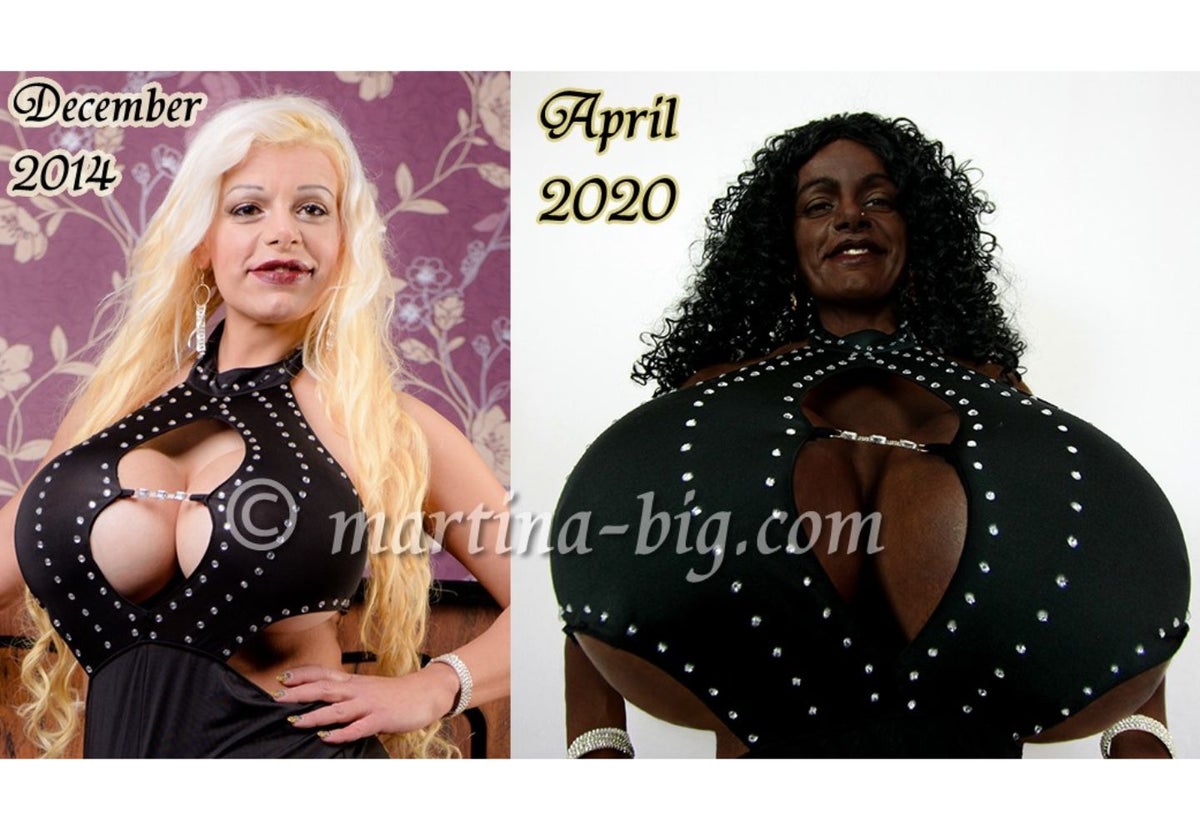 Martina Big, mujer que dice sentirse negra y cambió color de piel