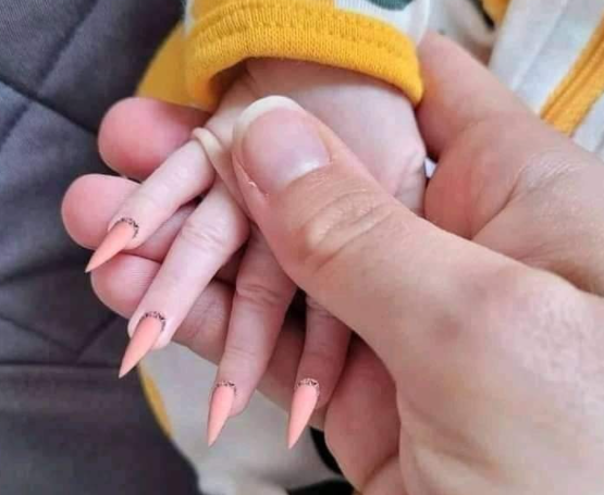 Uñas postizas en una bebé