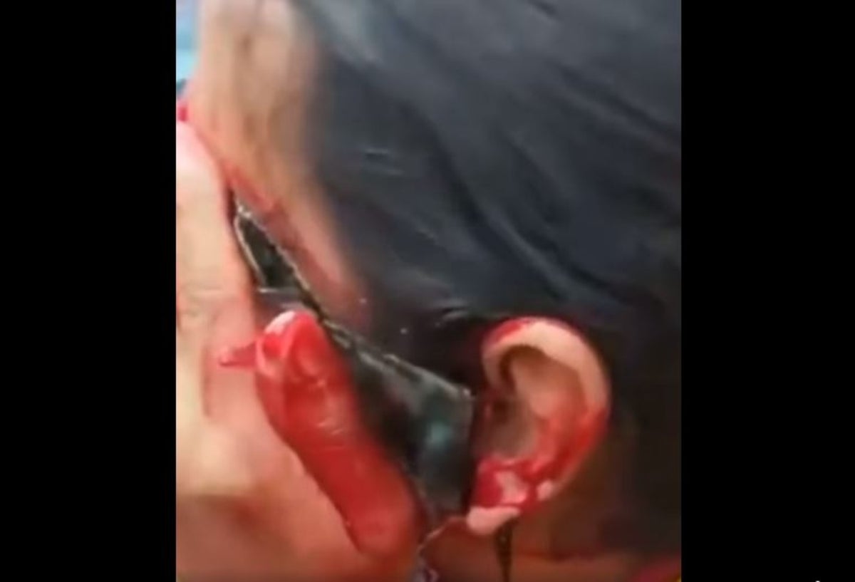 Funcionario de la Alcaldía de Kennedy fue herido en medio de las protestas