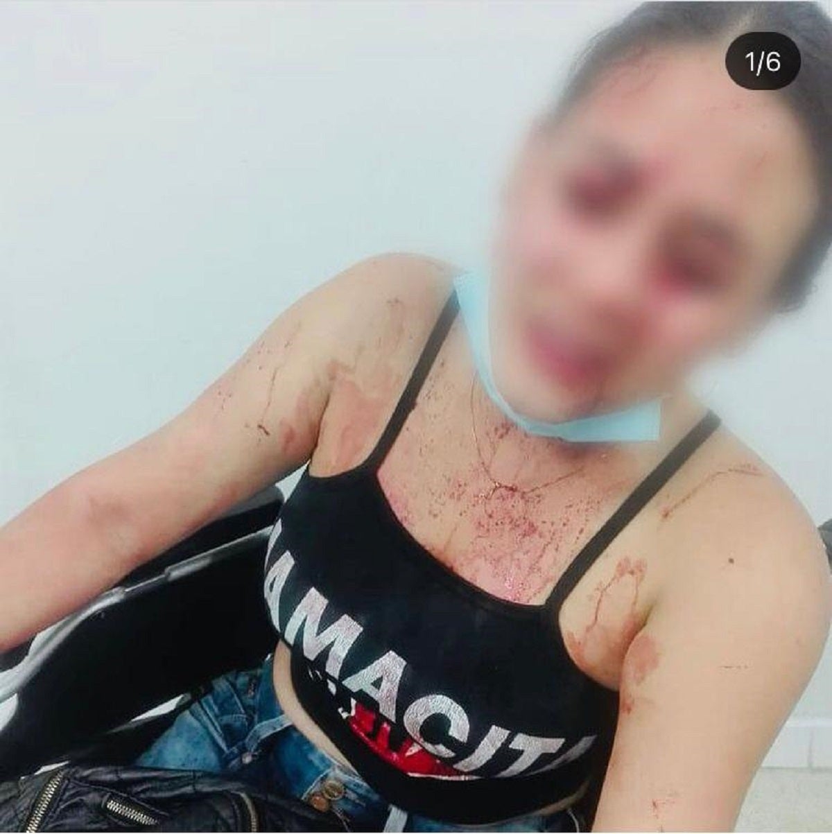 Caso ocurrido dentro de un bar
