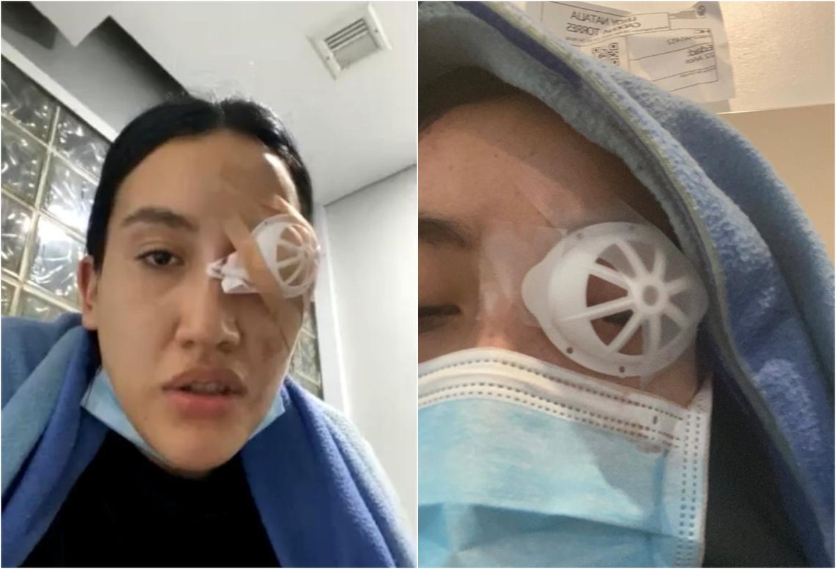 Universitaria perdió el ojo tras las protestas en Bogotá