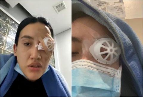 Universitaria perdió el ojo tras las protestas en Bogotá