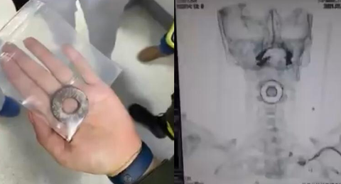 Policía herido Bucaramanga