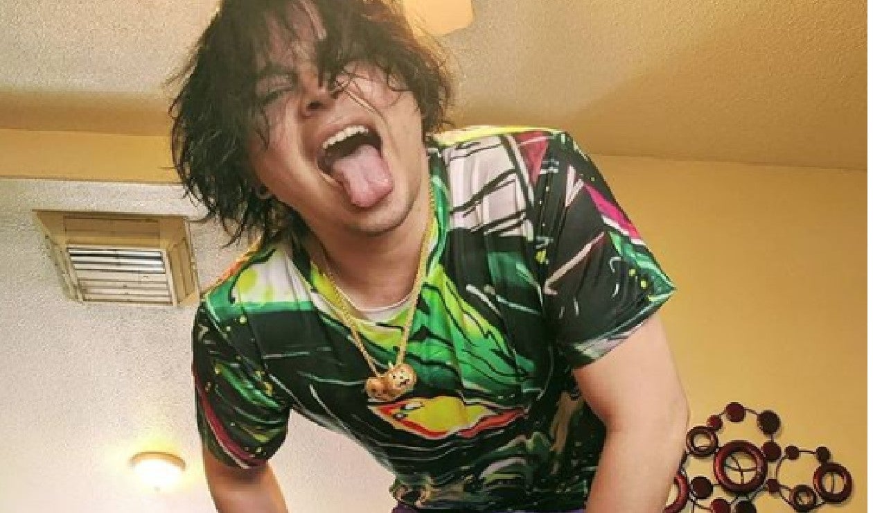 Influencer con implantes de oro