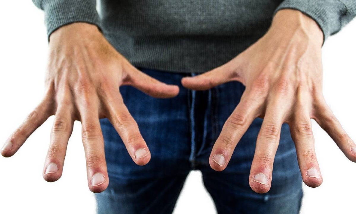Uñas