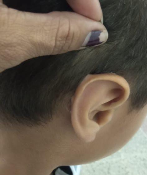 Insólito: A menor de edad le pegaron las orejas con gota mágica. Su padre sería el responsable
