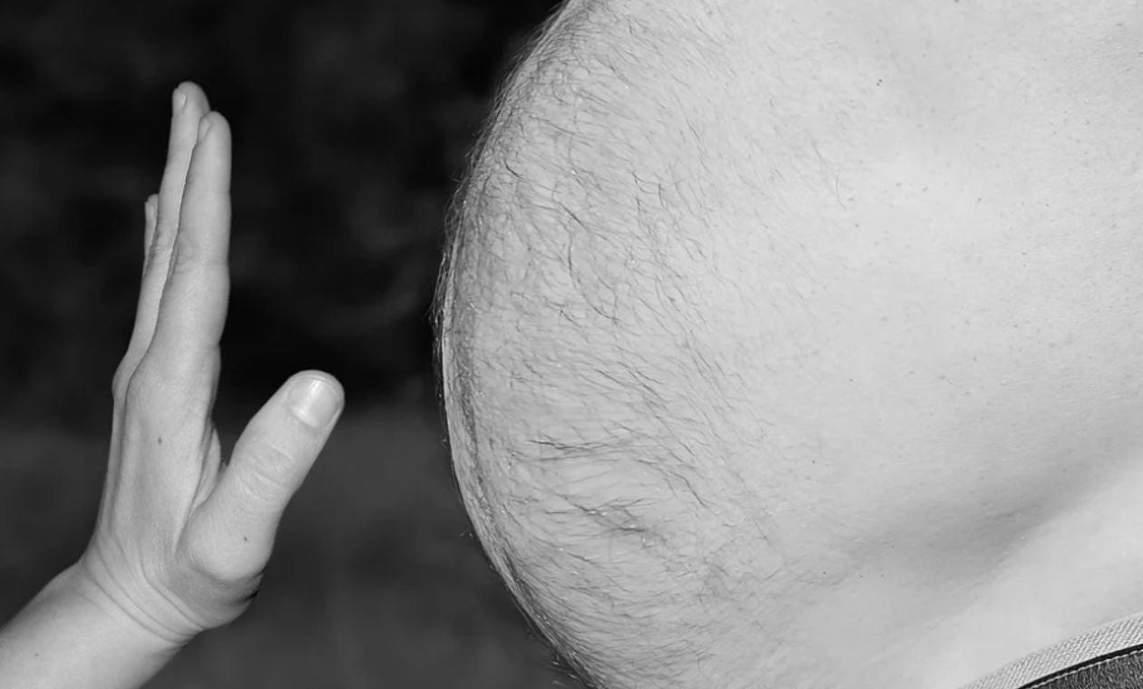 Obesidad / Sobrepeso / Obesidad afecta a 56 % de colombianos
