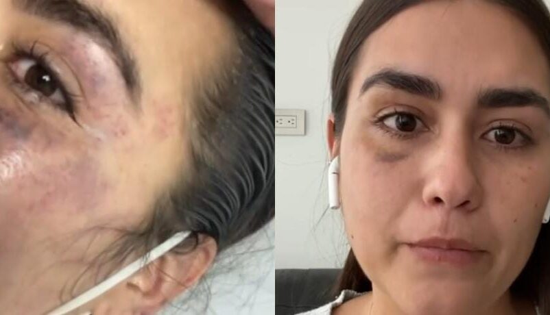 La diseñadora en medio de denuncia, mostró como quedó su rostro después de la agresión.