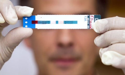 Día mundial del VIH 1 de diciembre: Aumento de infección no diagnosticada