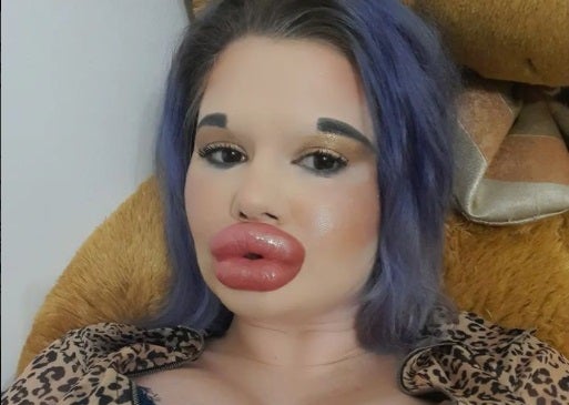 Andrea Emilova, mujer con los labios más grandes del mundo