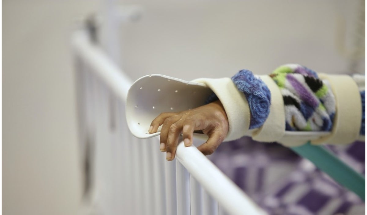 Niños quemados con pólvora en Navidad 2021.