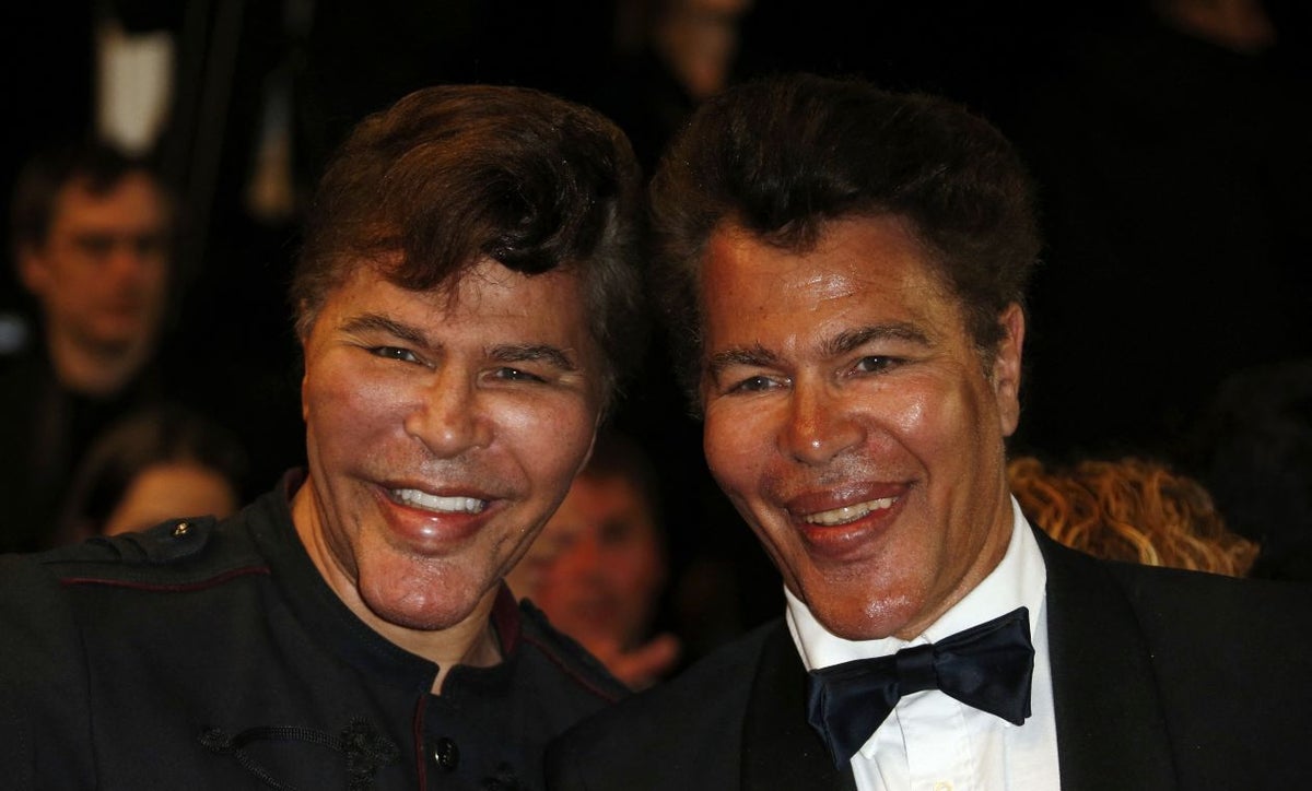 Igor y Grichka Bogdanoff: gemelos franceses mueren de covid-19