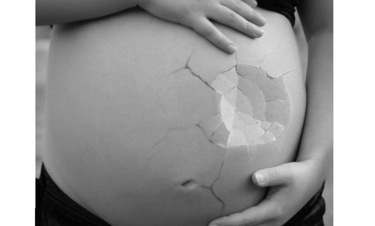 Aborto en Colombia: Proceso a seguir si un médico lo niega