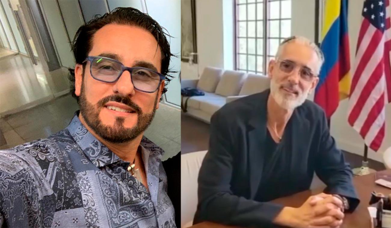 Miguel Varoni se realizó cirugías plásticas