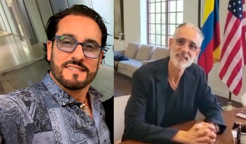 Miguel Varoni se realizó cirugías plásticas