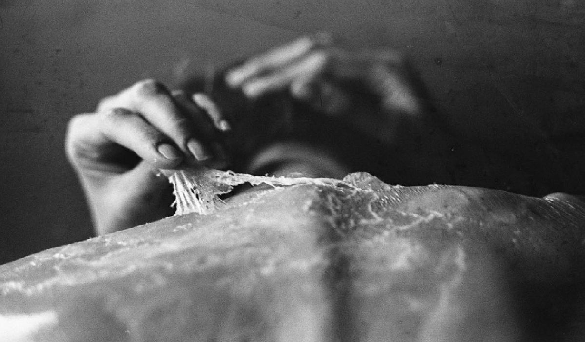 Piel de mariposa