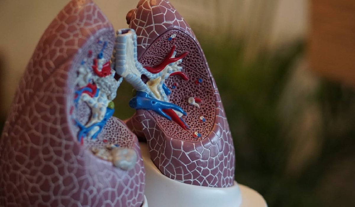 Hipertensión Arterial Pulmonar