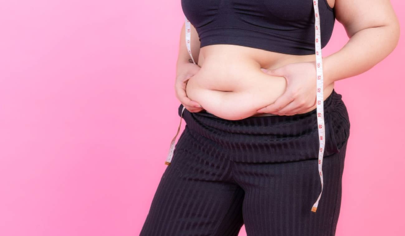 Mujer con obesidad mórbida