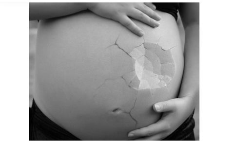 Aborto como Derecho: en EEUU mujeres viajan para poder acceder