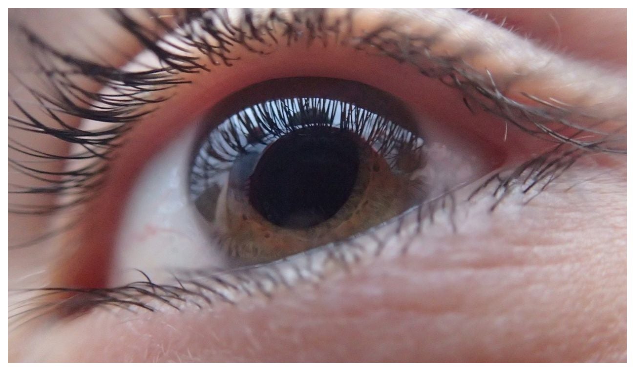 Discapacidad visual