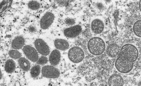 Virus de la viruela del mono