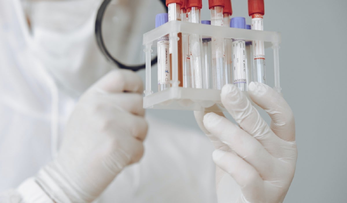 Muestras sobre los químicos en el cuerpo humano