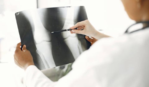 Osteoporosis