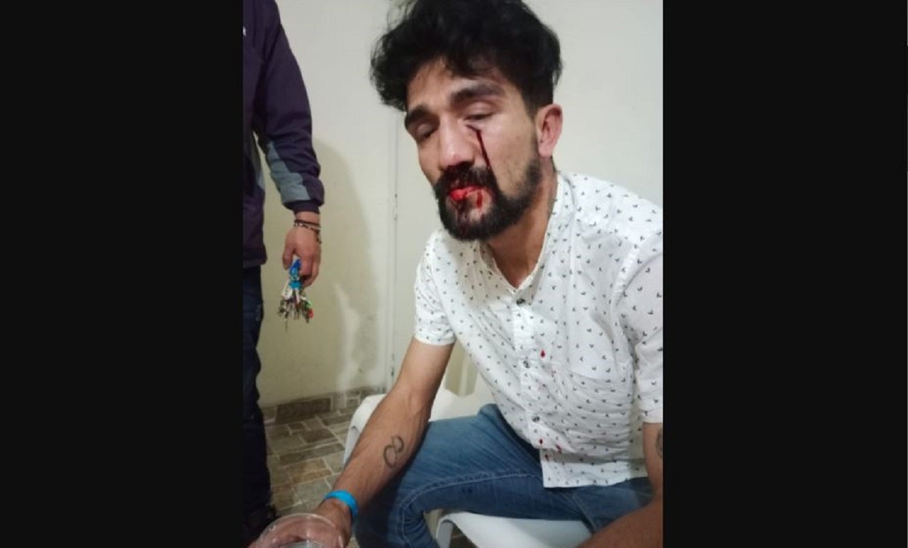 Kundaly Gómez, quien denunció una golpiza en la discoteca Theatron.