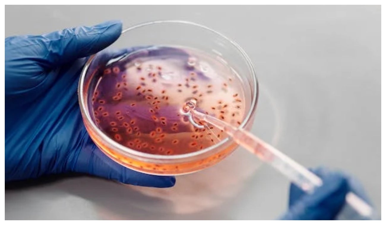 Las bacterias son la segunda causa de muerte a nivel mundial