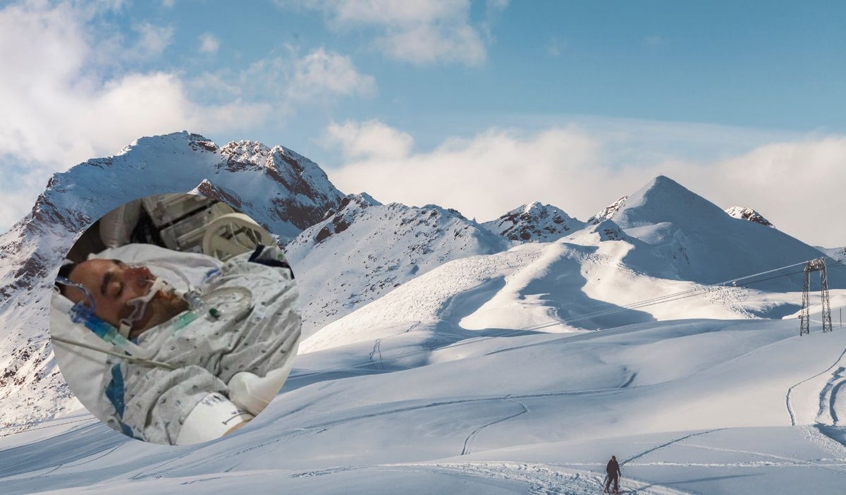 Hombre resucitó después de estar congelado