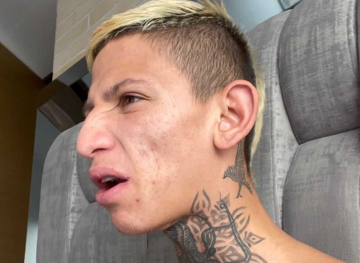 La Liendra se quitó los brackets