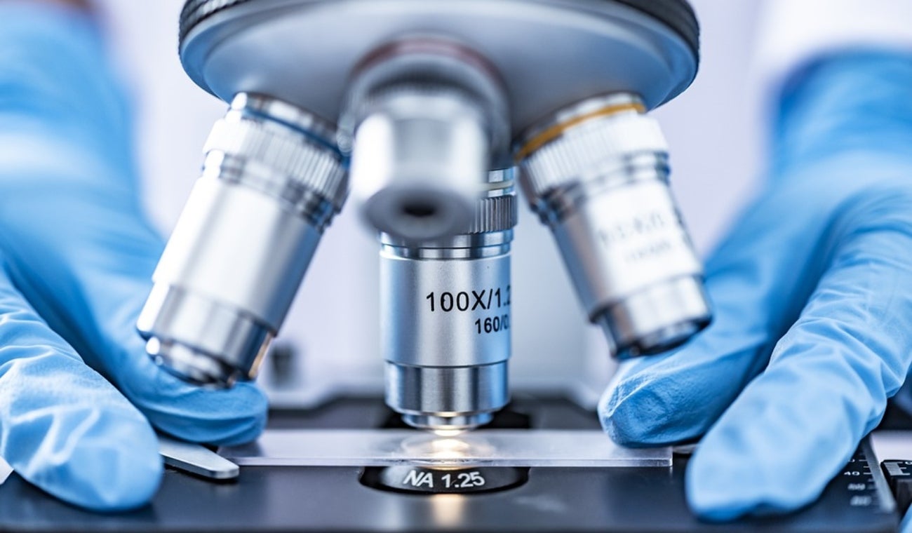 ADN: prueba sirve para establecer paternidad