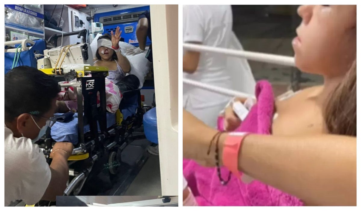 Emily Munera sufrió un accidente de tránsito y tuvo varias fracturas en su cara