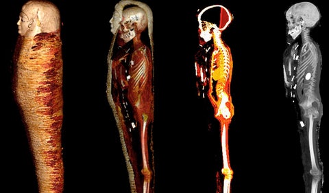 Momia con corazón de oro