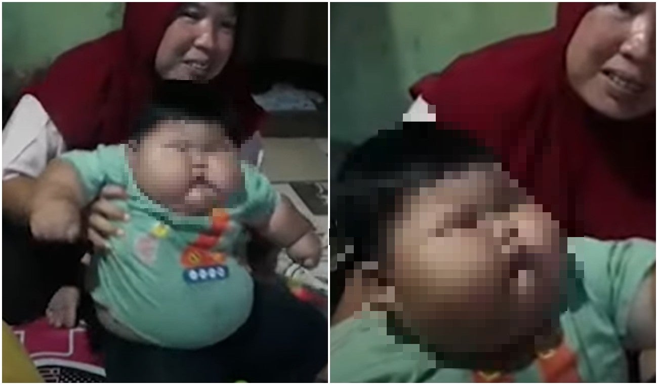 Bebé de 16 meses que pesa igual que un niño de 8 años