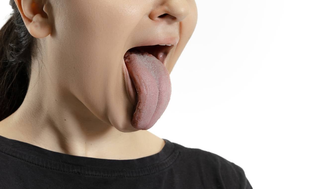 Limpiador de lengua