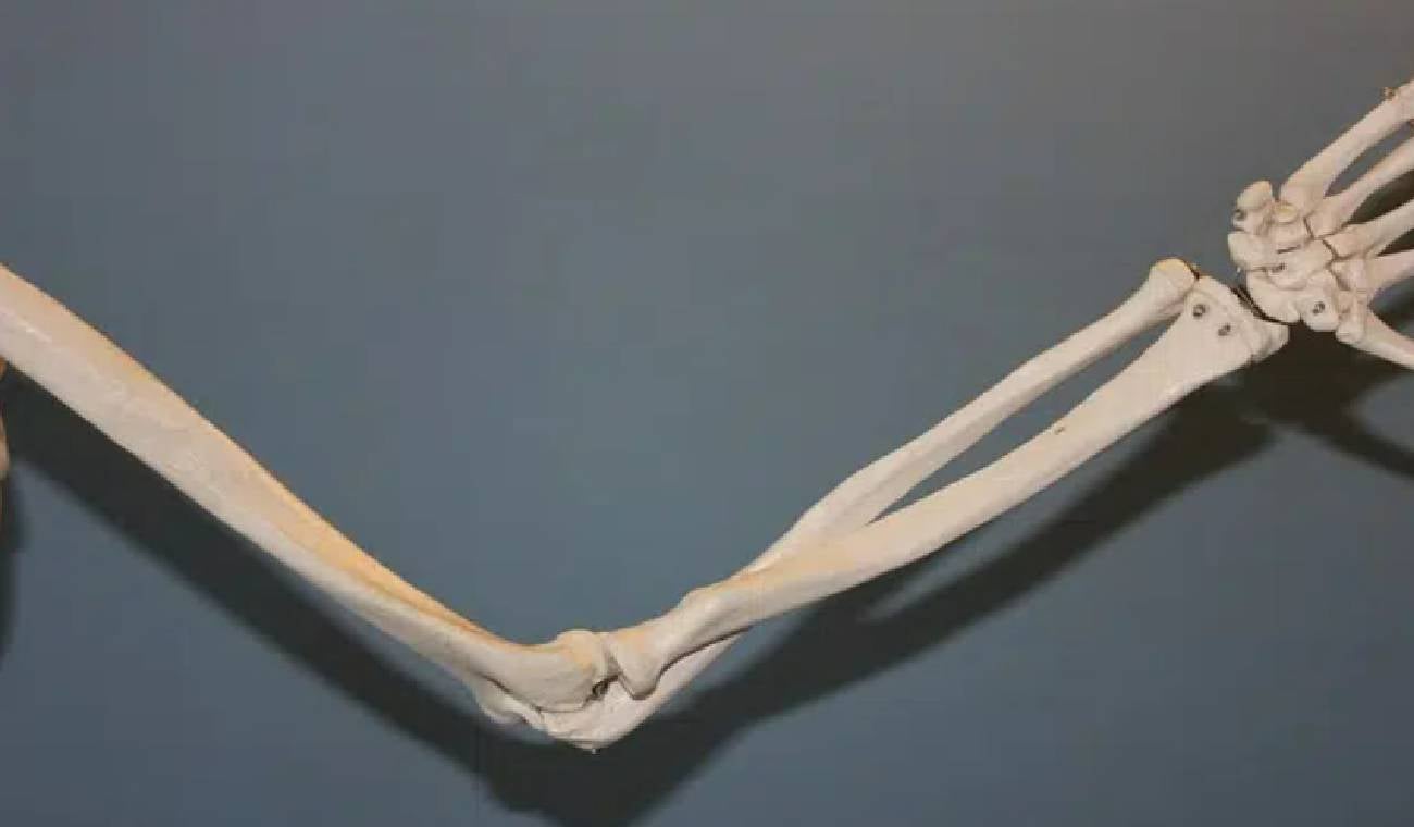 Codo