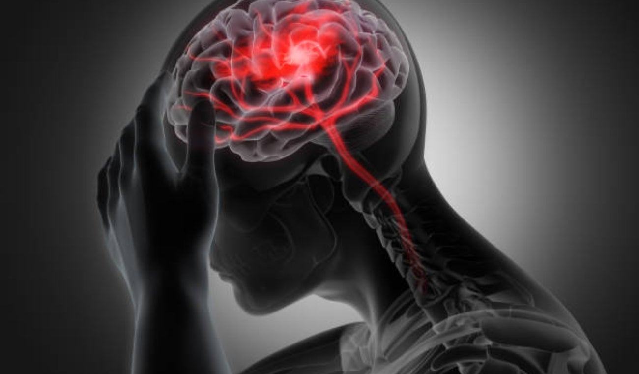 ¿Por qué sufro de migraña?