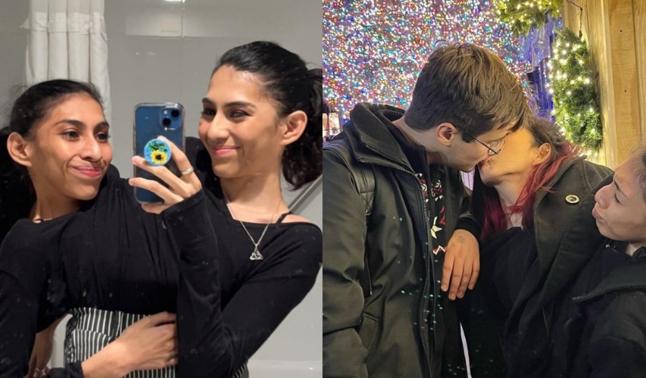 Siamesas completan dos años de relación con su novio y la intimidad es un tema complicado