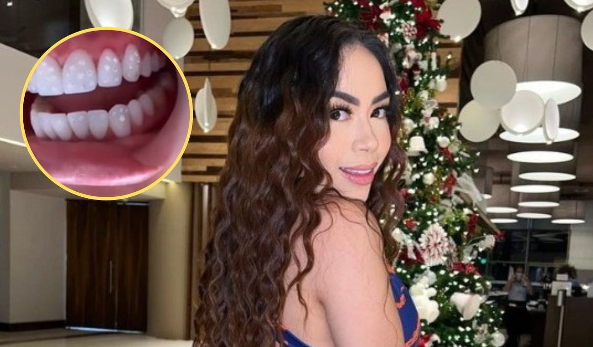 Epa Colombia y los diamantes en sus dientes: revela cómo fue el ostentoso procedimiento