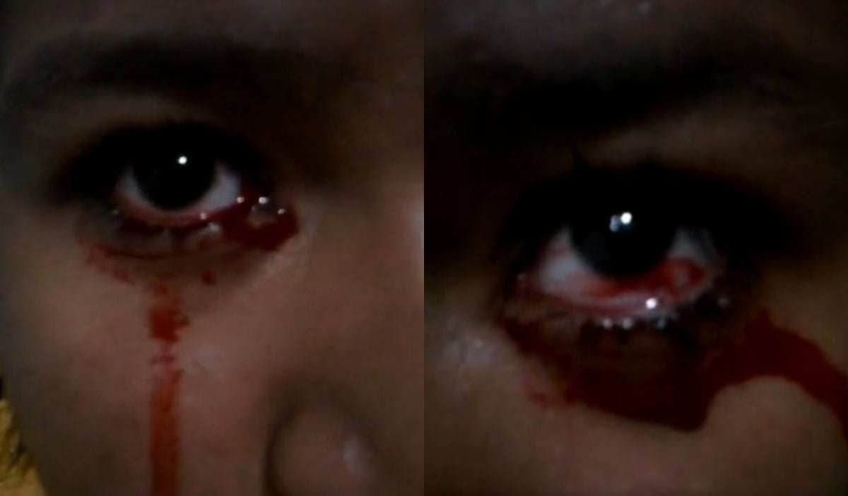 Menor llora lágrimas de sangre
