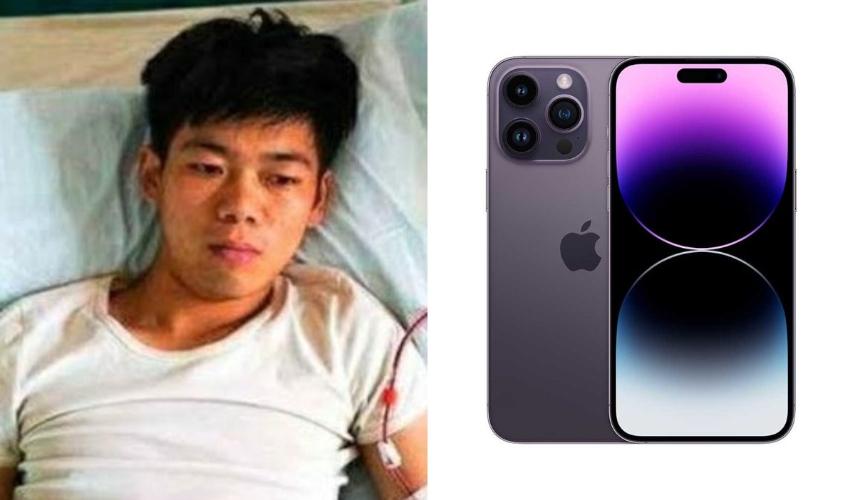Vendió un riñón por un iPhone
