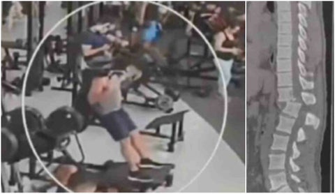 [Video] Hombre sufrió accidente con una máquina muy usada en los gimnasios: no volverá a caminar