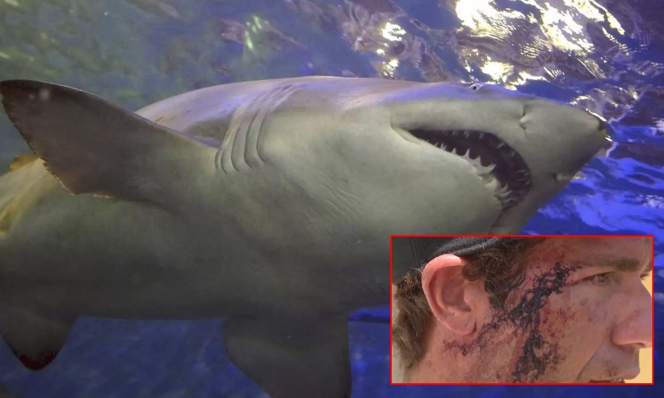 Tiburón mordió en el rostro a un surfista