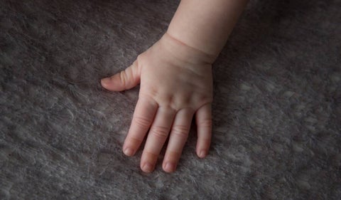 Dermatitis Atópica