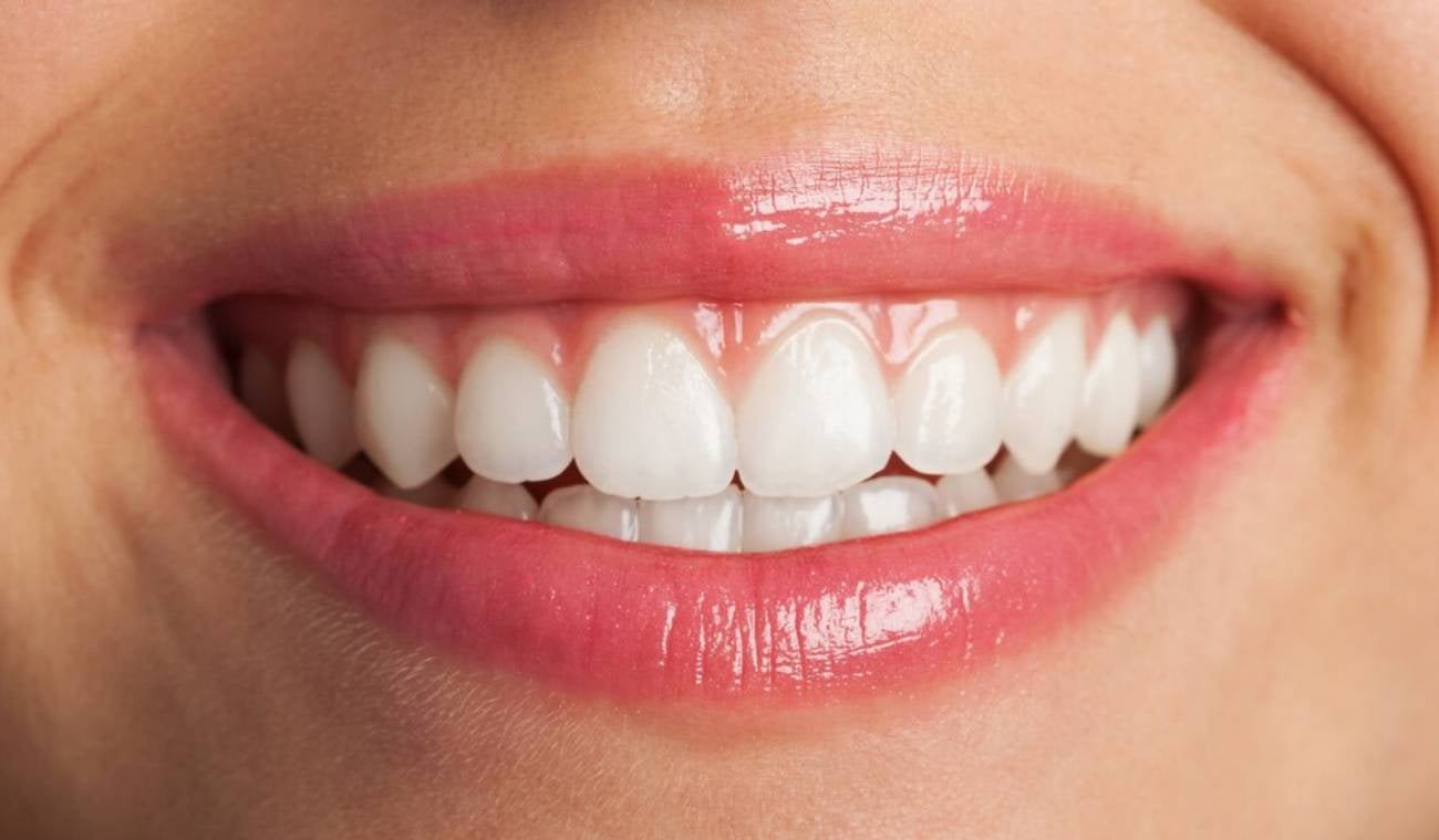 Dientes