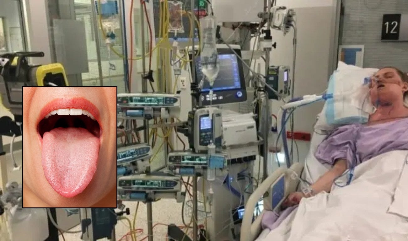 Mujer queda en coma tras morderse la lengua