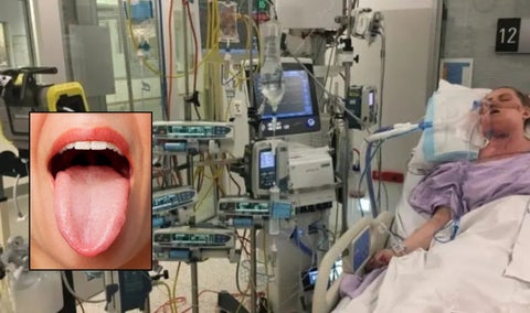Mujer queda en coma tras morderse la lengua